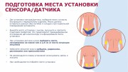 Памятка для родителей детей с сахарным диабетом 1 типа в возрасте от 2-х до 17 лет по использованию систем непрерывного мониторинга глюкозы